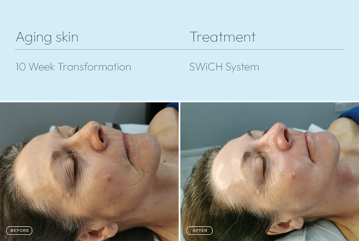 Aging skin 2 1200