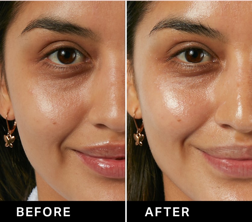HydraFacial 1