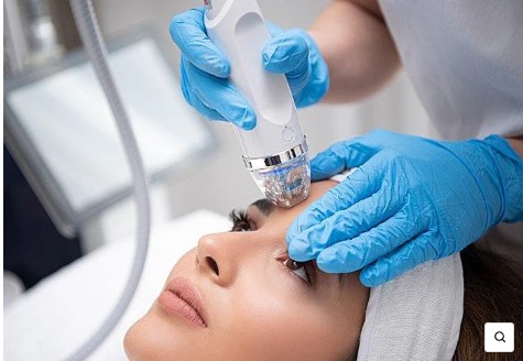 Microneedling