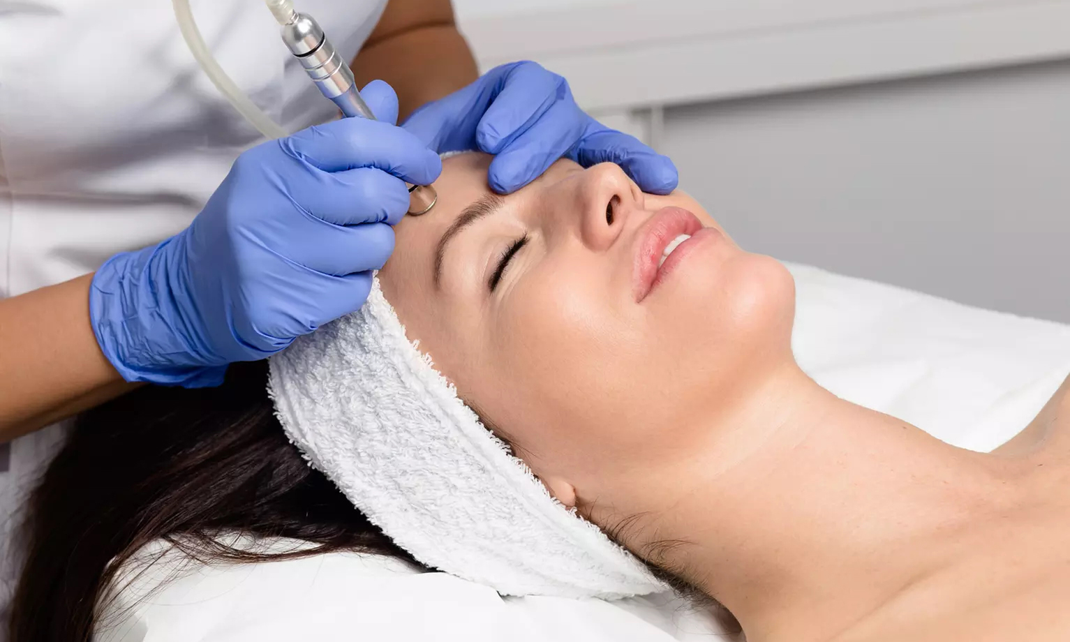 dermabrasion 0