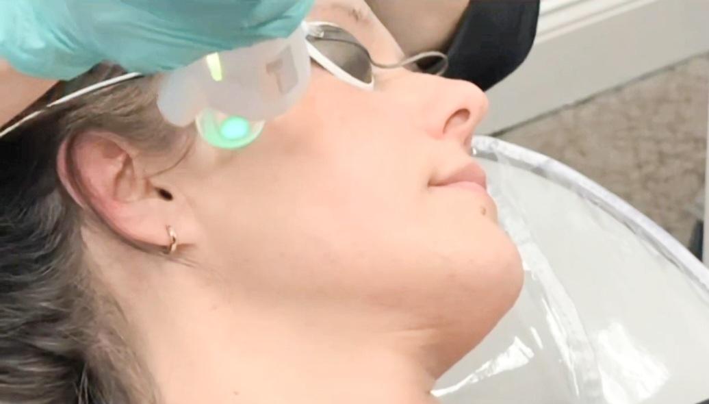 Non-Surgical Cosmetic Procedures